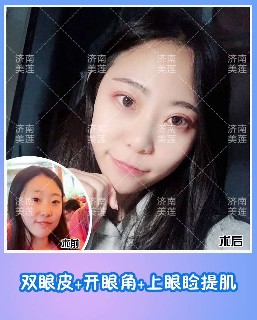 你听过韩式三点么?"三点"究竟指的哪里?