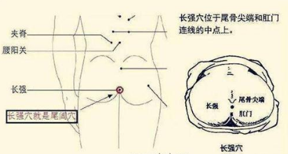 得了痔疮怎么办,艾灸长强穴效果好 .艾灸常识