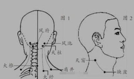 艾灸治疗风寒头痛的穴位和方法 .艾灸常识