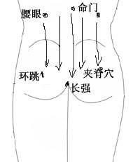 艾灸治病：如何用艾灸调理痔疮 .艾灸常识