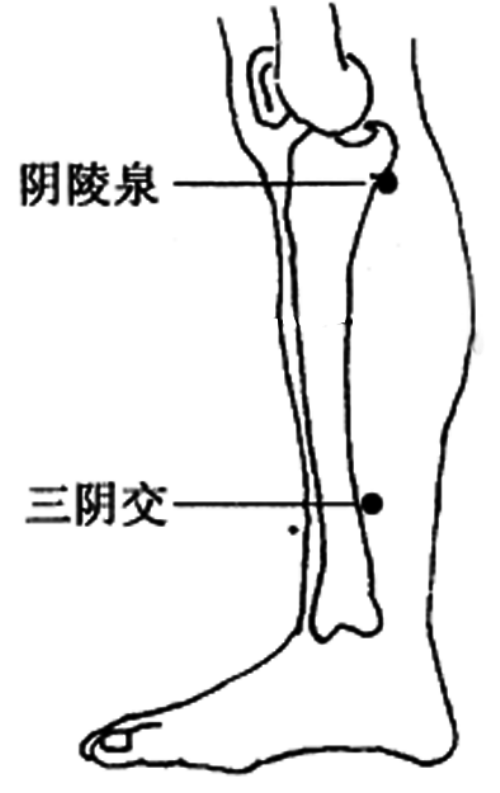 痹证的艾灸疗法 .艾灸常识