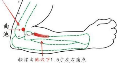 湿疹能根治吗？艾灸治疗湿疹的方法 .艾灸常识