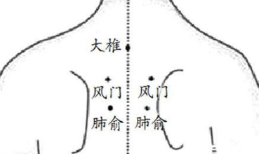 小儿肺炎的艾灸治疗方法和案例 .艾灸常识