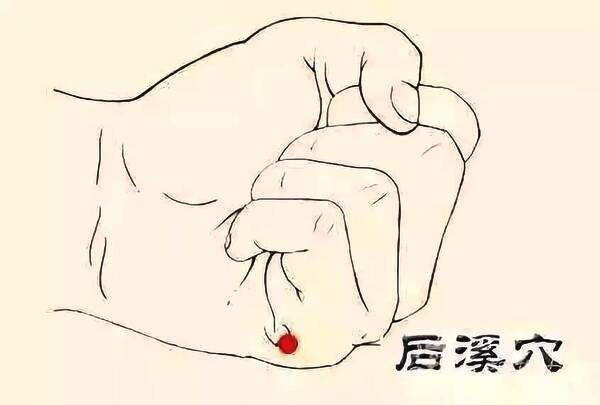 艾灸美容 艾灸后溪穴治麦粒肿 .艾灸常识
