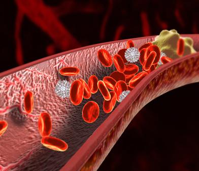 "10秒钟"清理你的血管,血栓最怕这个动作
