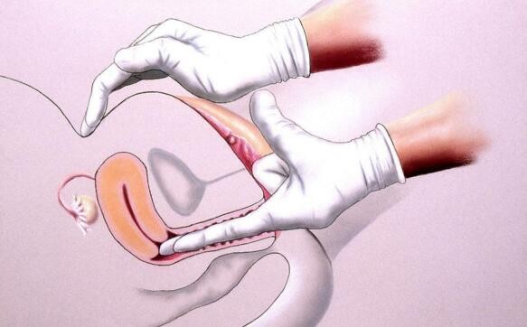 妇科检查前注意事项