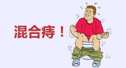 广州东大肛肠医院——痔疮.jpg