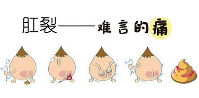 广州东大肛肠医院——肛裂.jpg