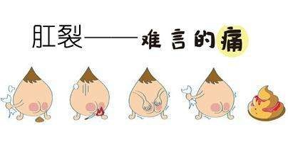 广州东大肛肠医院——肛裂.jpg