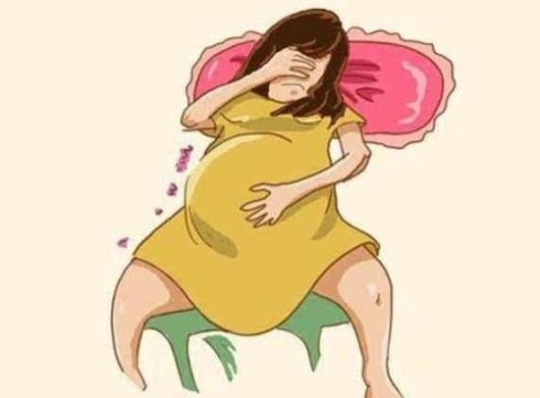 广州东大肛肠医院——痔疮.jpg