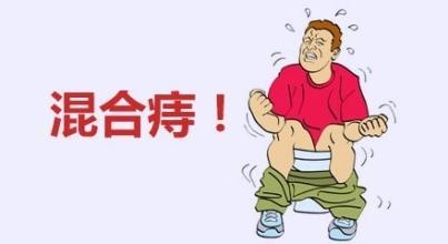 广州东大肛肠医院——痔疮.jpg